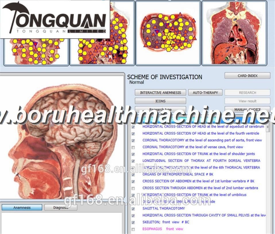 5d nls health test machine with capsule hot sale low price