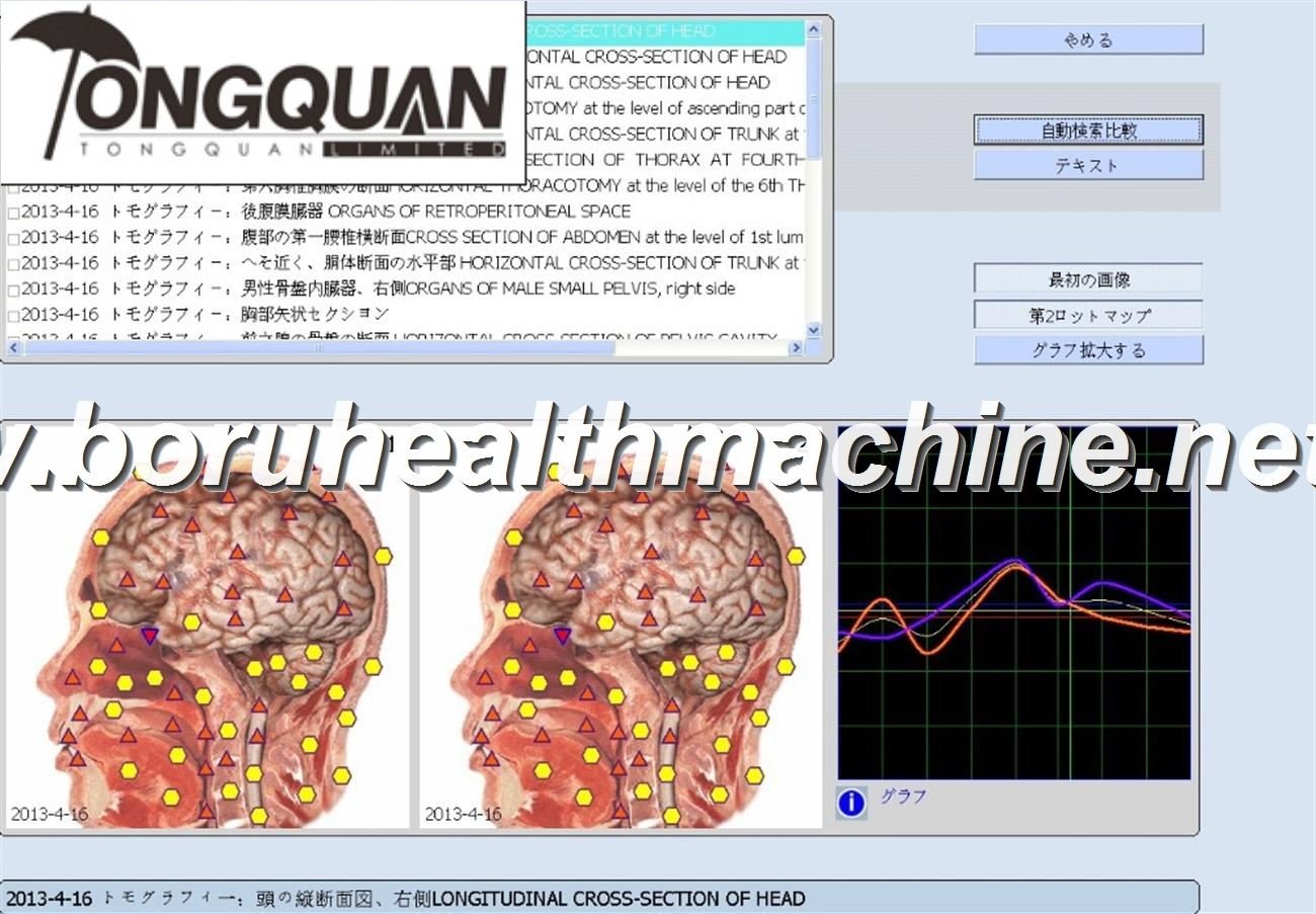 3d/ 9d nls system Health Analyzer capsule quantum resonance techniques